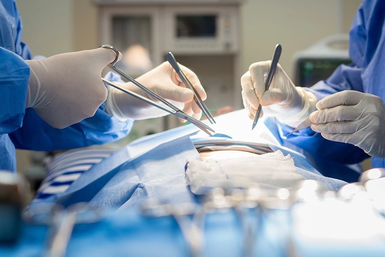 General Surgery General Surgery